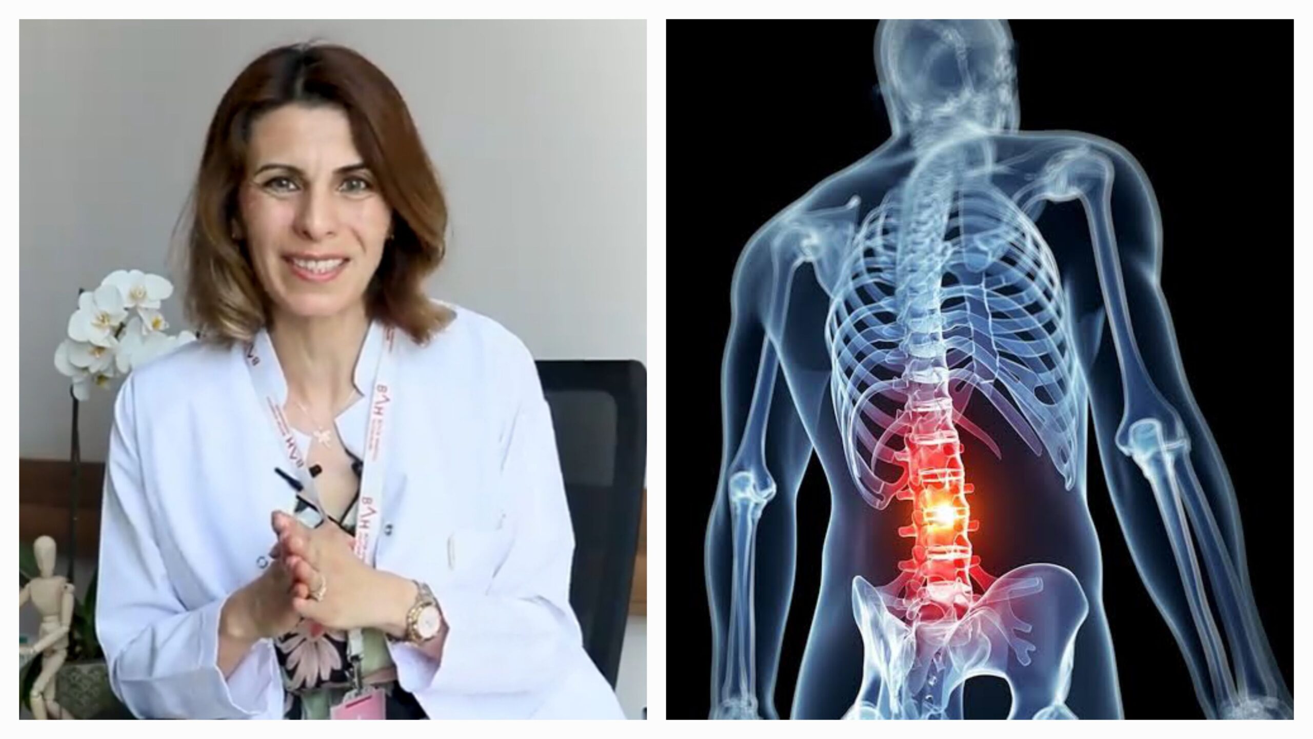 Bel fıtığı nedir? Bel fıtığı tedavisinde fizik tedavi ve rehabilitasyonun yeri nedir?