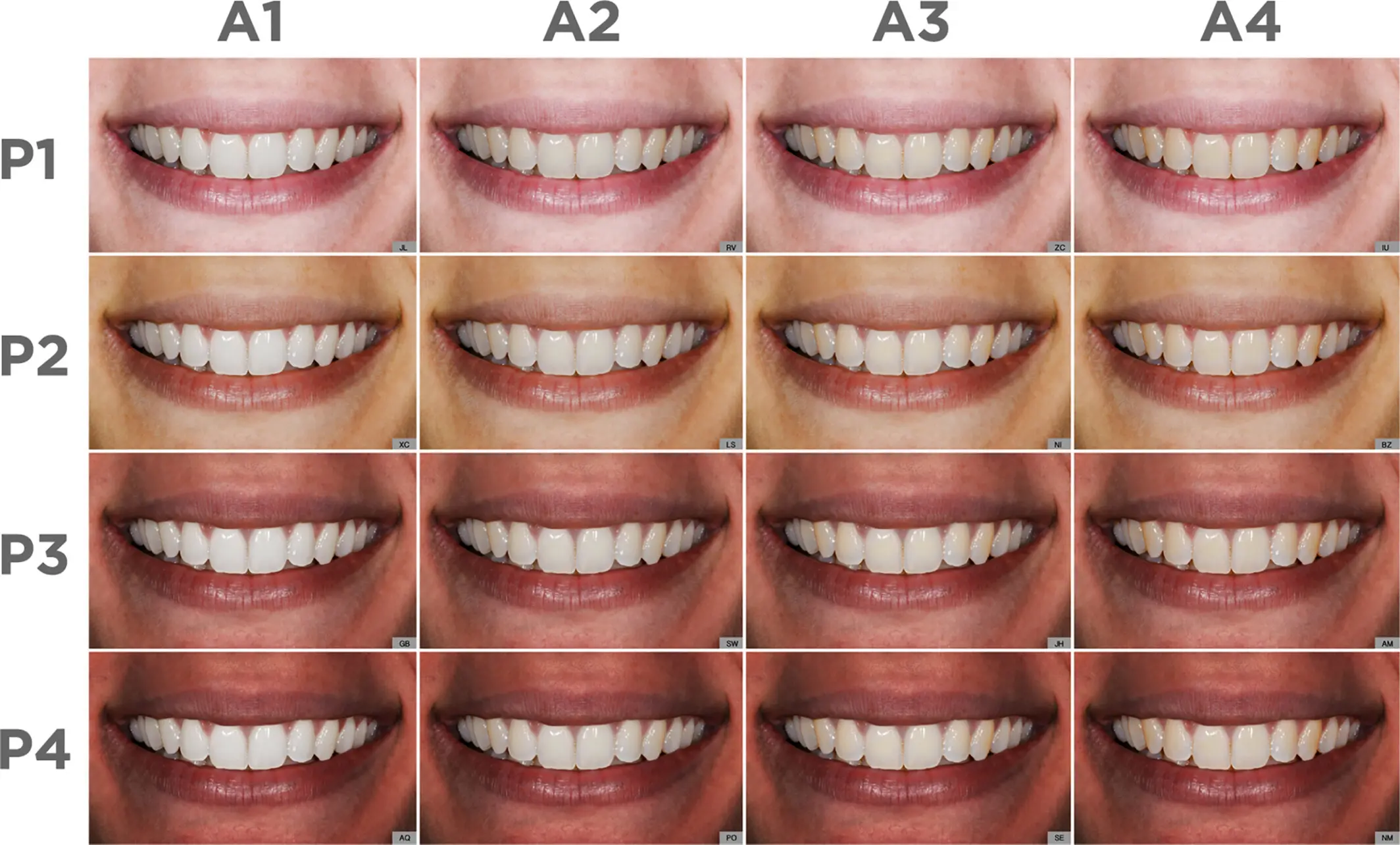 Diş şekline göre kişiliğinizin analizi