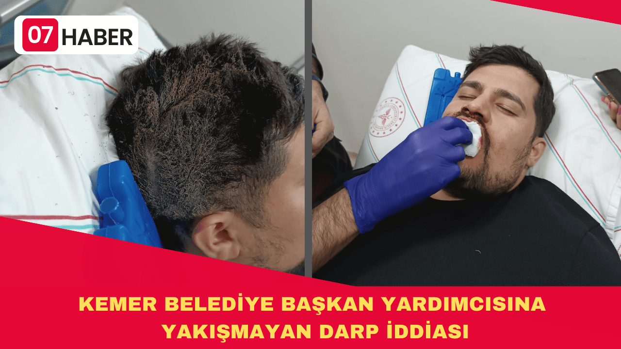 KEMER BELEDİYE BAŞKAN YARDIMCISINA YAKIŞMAYAN DARP İDDİASI