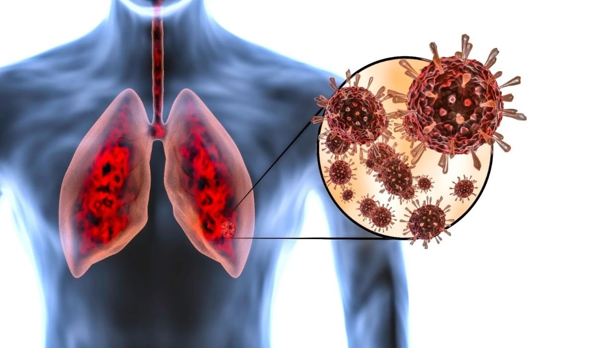 Kekik: Akciğer Enfeksiyonuna Doğal Çözüm Olabilir!