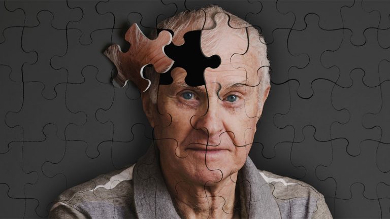 ABD'li araştırmacılar, Alzheimer hastalığının
