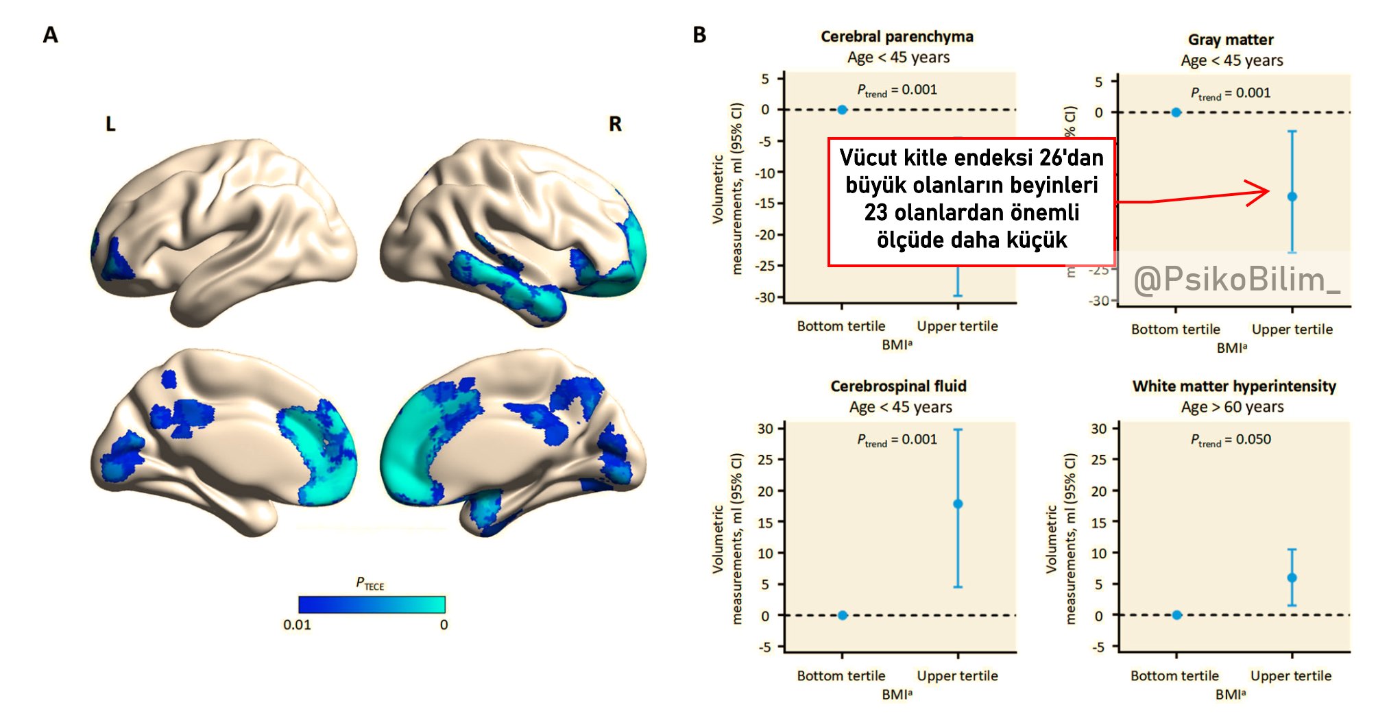 Aşırı Kilo Beyni 12 Yıl Yaşlandırıyor: Beyin Sağlığı İçin Vücut Kitle Endeksini 26'nın Altında Tutun