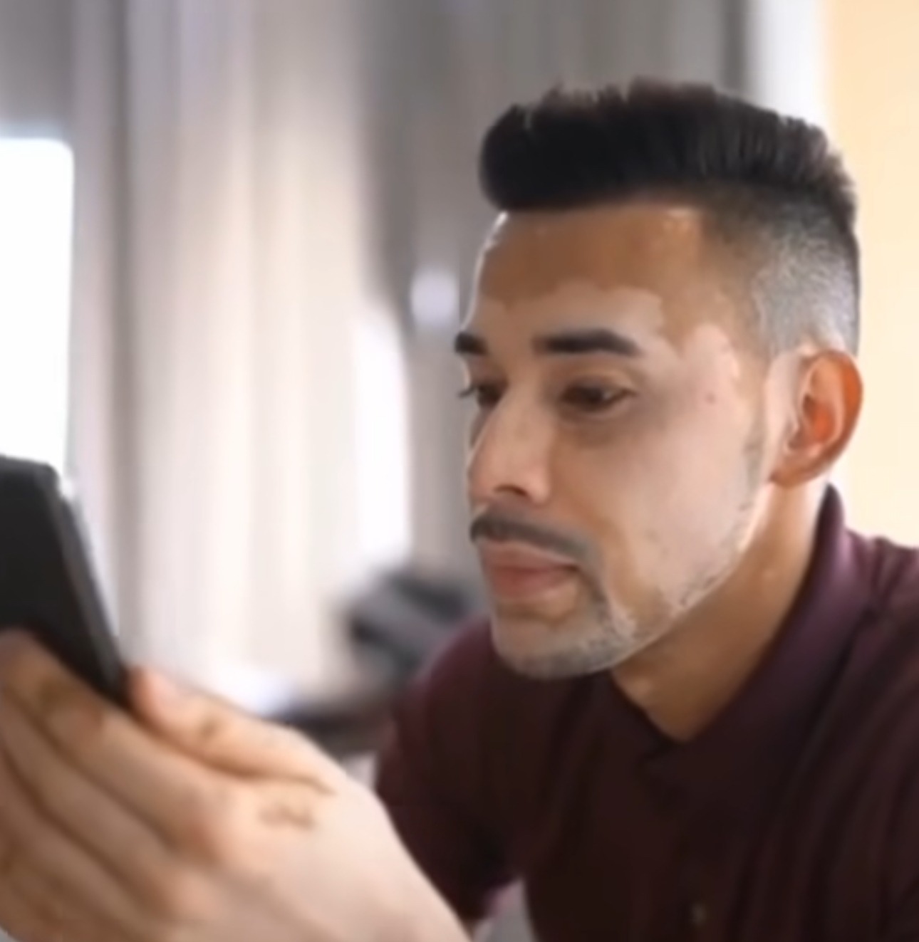 Ciltteki Renk Değişimine Yol Açan Durumun Etkileri