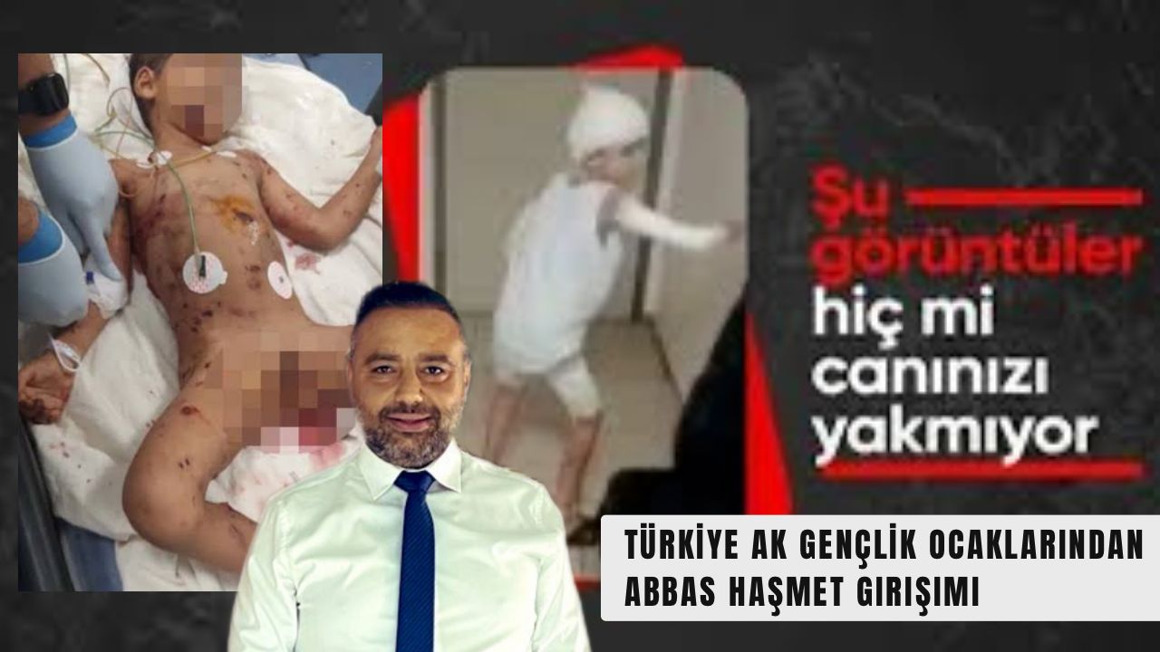 Türkiye’de Başıboş Köpek Sorunu: Abbas Haşmet Yoğun Bakımda