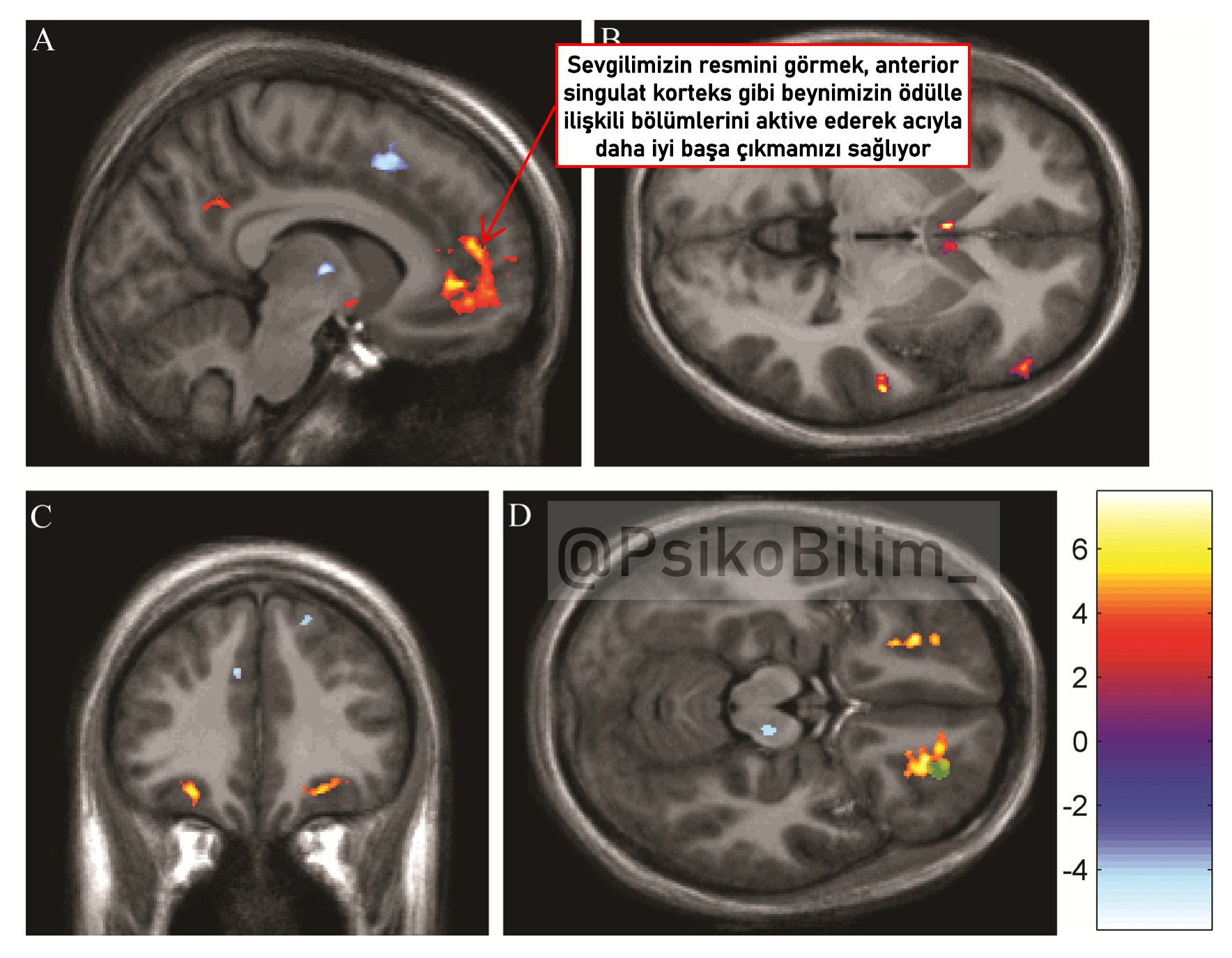 Sevgilimizin Resminin Bile Ağrı Kesici Etkisi Var
