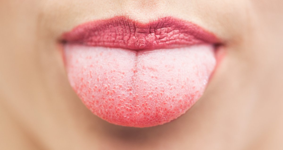 Doktor Ziyaretinde Dikkat: Diliniz Sağlığınız Hakkında Önemli İpuçları Verebilir