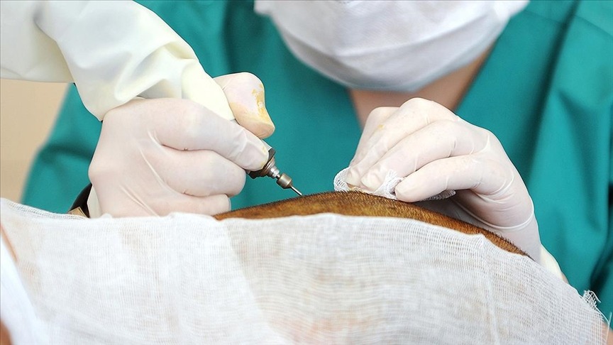 Türkiye, Sağlık Turizminde 2.3 Milyar Dolar Gelir Elde Etti: Kayıt Dışı Çalışanlar Piyasanın %40'ına Ulaştı