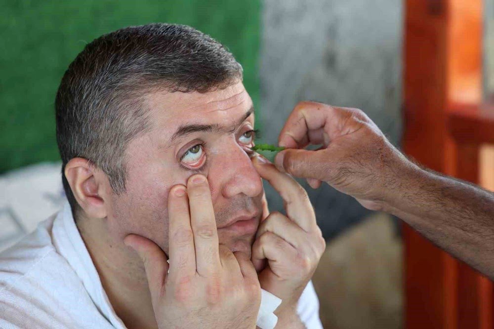 Kırlangıç ​​Otu: Geleneksel Tıbbın Şifa Kaynağı