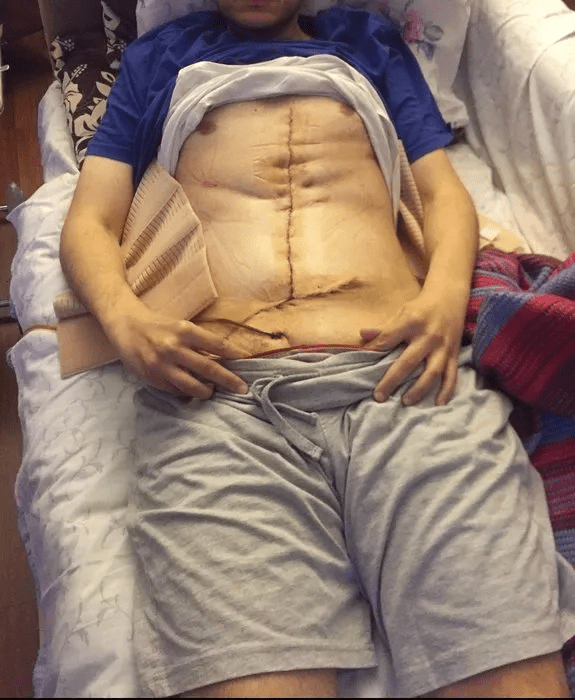 Bir Sağlık Skandalı Daha: "Mideni Çöpe Attım"