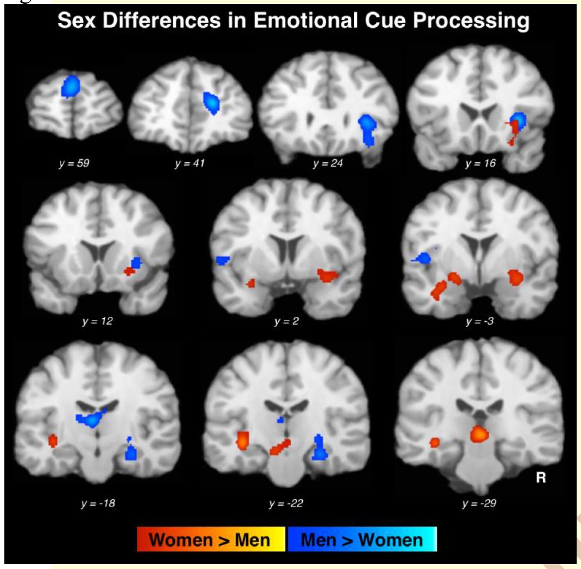 Kadın ve Erkekler Duygusal Uyaranlara Karşı Farklı Beyin Bölgelerini Kullanıyor