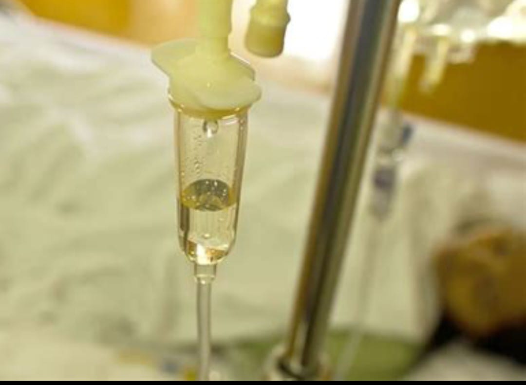 Sarı Serum Uygulamaları Sonrası Ölümler: Uzmanlar Uyarıyor